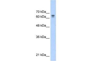 Western Blotting (WB) image for anti-Poly (ADP-Ribose) Polymerase Family, Member 6 (PARP6) antibody (ABIN2460859) (PARP6 anticorps)