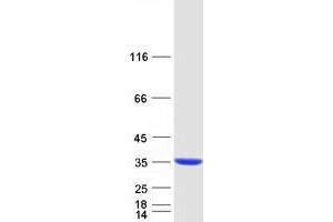 Validation with Western Blot