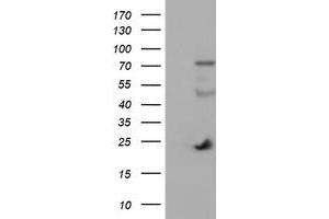 Western Blotting (WB) image for anti-Immunoglobulin J Polypeptide, Linker Protein For Immunoglobulin alpha and mu Polypeptides (IGJ) antibody (ABIN1498839) (IGJ anticorps)