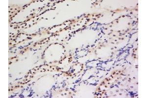 Formalin-fixed and paraffin embedded human kidney labeled with Anti-PIWIL1 Polyclonal Antibody, Unconjugated  at 1:200 followed by conjugation to the secondary antibody and DAB staining. (PIWIL1 anticorps  (AA 551-650))