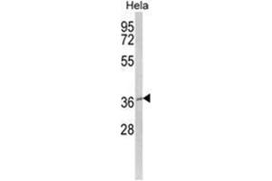 Western blot analysis of MOSC2 Antibody (C-term) in Hela cell line lysates (35ug/lane). (MARC2 anticorps  (C-Term))