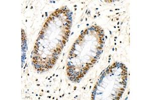 Immunohistochemistry of paraffin embedded human colon using MST1 (ABIN7075561) at dilution of 1: 1000 (400x lens)