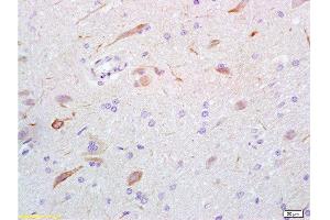 Formalin-fixed and rat brain tissue labeled with Anti-GABA Polyclonal Antibody, Unconjugated  at 1:200 followed by conjugation to the secondary antibody and DAB staining (GABA anticorps)