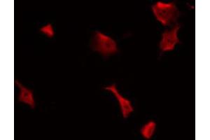 ABIN6269322 staining NIH-3T3 by IF/ICC. (FAK anticorps  (Internal Region))