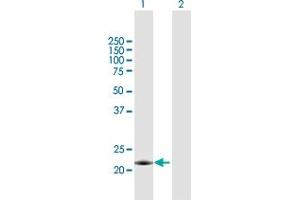 Western Blot analysis of MID1IP1 expression in transfected 293T cell line by MID1IP1 MaxPab polyclonal antibody. (m1ip1 anticorps  (AA 1-183))