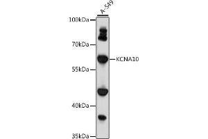 Western blot analysis of extracts of A-549 cells, using KCN antibody (ABIN7269485) at 1:1000 dilution. (KCNA10 anticorps  (AA 1-125))