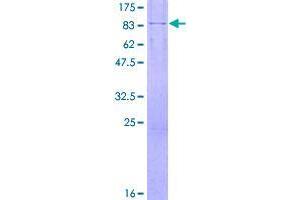 Image no. 1 for Doublecortin Domain Containing 2 (DCDC2) (AA 1-476) protein (GST tag) (ABIN1351183)