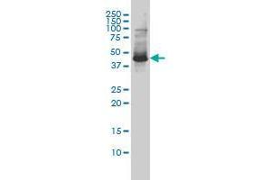 ZNF174 monoclonal antibody (M01), clone 2D7-E9 Western Blot analysis of ZNF174 expression in SW-13 .