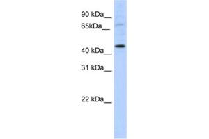 Western Blotting (WB) image for anti-LIM Homeobox Transcription Factor 1, alpha (LMX1A) antibody (ABIN2461616)