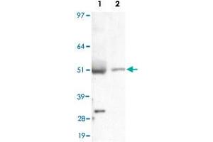 Detection of LIPF in liver lysate using LIPF polyclonal antibody . (LIPF anticorps  (AA 1-100))