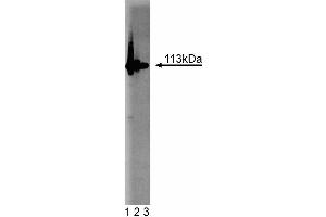 Western blot analysis of PARP on Jurkat cell lysate. (PARP1 anticorps  (AA 22-219))