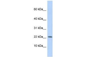 P2RX7 antibody used at 1 ug/ml to detect target protein.