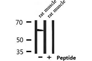 Western blot analysis of extracts from rat muscle, using GPR148 Antibody.