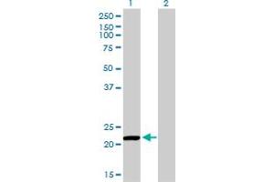 Western Blotting (WB) image for anti-Peroxiredoxin 2 (PRDX2) (AA 1-199) antibody (ABIN598967) (Peroxiredoxin 2 anticorps  (AA 1-199))