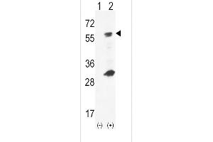Western blot analysis of GCK using rabbit polyclonal hGCK-S418 using 293 cell lysates (2 ug/lane) either nontransfected (Lane 1) or transiently transfected (Lane 2) with the GCK gene. (GCK anticorps  (C-Term))