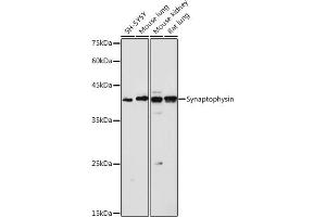 Western blot analysis of extracts of various cell lines, using Synaptophysin antibody (ABIN6135349, ABIN6148783, ABIN6148784 and ABIN6221958) at 1:1000 dilution. (Synaptophysin anticorps  (AA 150-250))