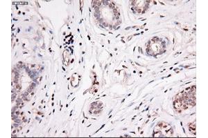 Immunohistochemical staining of paraffin-embedded breast using anti-Nog (ABIN2452676) mouse monoclonal antibody. (NOG anticorps  (AA 28-232))
