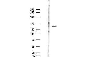 Western blot analysis of lysates from LoVo cells(heat-shock,45 min treatment), using RGS6 Antibody at 1/1000 dilution.
