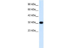 WB Suggested Anti-HS747E2A Antibody Titration:  1. (C22orf31 anticorps  (Middle Region))