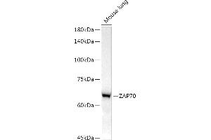 Western blot analysis of extracts of Mouse lung, using Z antibody (ABIN7271430) at 1:1000 dilution. (ZAP70 anticorps)