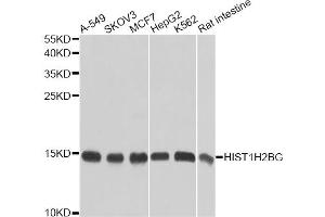 Western blot analysis of extracts of various cell lines, using HIST1H2BG antibody. (HIST1H2BG anticorps)