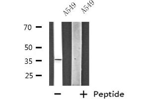 Western blot analysis of extracts from HeLa cells, using ZNF691 antibody. (ZNF691 anticorps  (Internal Region))