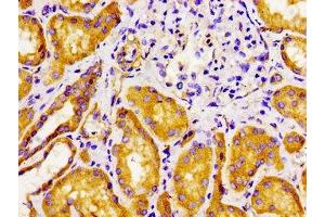 Immunohistochemistry of paraffin-embedded human kidney tissue using ABIN7153179 at dilution of 1:100 (FZD1 anticorps  (AA 125-225))