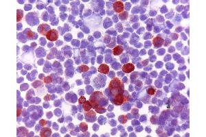 Immunohistochemistry (IHC) image for anti-S100 Calcium Binding Protein A8 (S100A8) antibody (ABIN920692)