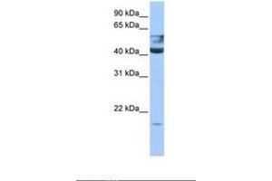 Image no. 1 for anti-Queuine tRNA-Ribosyltransferase 1 (QTRT1) (AA 45-94) antibody (ABIN6738529) (QTRT1 anticorps  (AA 45-94))