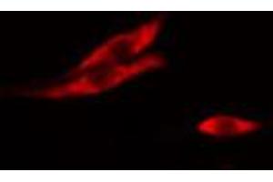 ABIN6267021 staining A-431 cells by IF/ICC. (TRHR anticorps)