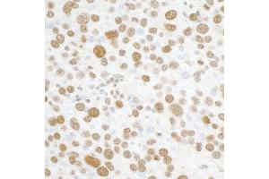 Immunohistochemistry (IHC) image for anti-H2A Histone Family, Member X (H2AFX) (C-Term) antibody (ABIN7449536) (H2AFX anticorps  (C-Term))
