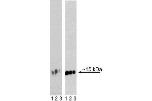 Western blot analysis of H2AX (pS139) in transformed human epithelioid carcinoma. (H2AFX anticorps  (pSer139))