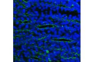 IF analysis of SLC12A1 using anti-SLC12A1 antibody (ABIN3043925).