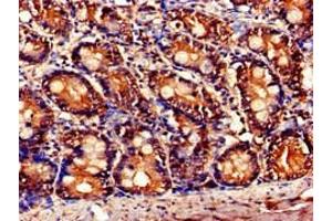 Immunohistochemistry of paraffin-embedded human small intestine tissue using ABIN7145827 at dilution of 1:100 (TNFAIP1 anticorps  (AA 233-316))