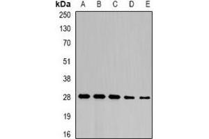 Western blot analysis of NFU1 expression in SW480 (A), mouse liver (B), mouse heart (C), rat liver (D), rat heart (E) whole cell lysates. (NFU1 anticorps)