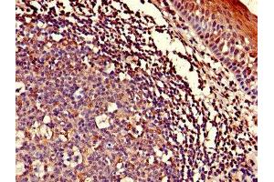 Immunohistochemistry of paraffin-embedded human tonsil tissue using ABIN7143153 at dilution of 1:100 (ASCC1 anticorps  (AA 1-315))