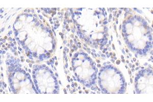 Detection of ZRF1 in Human Colon Tissue using Polyclonal Antibody to Zuotin Related Factor 1 (ZRF1)