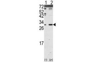 Image no. 2 for anti-Dickkopf 2 Homolog (DKK2) (N-Term) antibody (ABIN357069) (DKK2 anticorps  (N-Term))