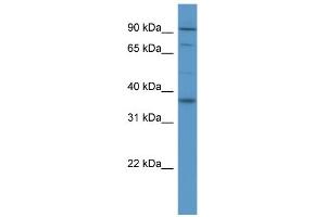 WB Suggested Anti-FGFR2 Antibody Titration: 0. (FGFR2 anticorps  (Middle Region))