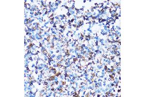 Immunohistochemistry of paraffin-embedded human tonsil using SPN antibody (ABIN5973813) at dilution of 1/100 (40x lens). (CD43 anticorps)