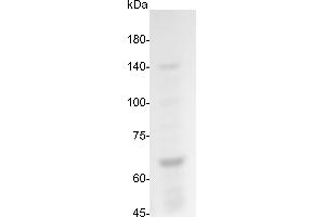 Influenza Virus Nucleoprotein (IV NP) protein (His tag)