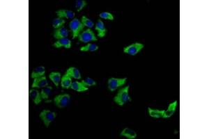 Immunofluorescence staining of Hela cells with ABIN7148294 at 1:166, counter-stained with DAPI. (MCC anticorps  (AA 479-611))