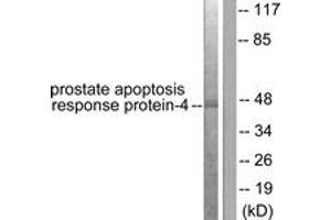 Western blot analysis of extracts from NIH-3T3 cells, using Prostate Apoptosis Response protein-4 Antibody. (PAWR anticorps  (AA 291-340))
