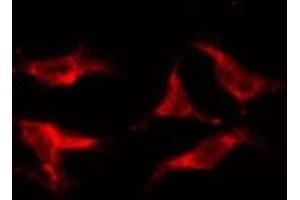 ABIN6278181 staining HepG2 by IF/ICC.