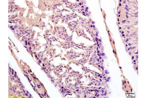 Formalin-fixed and paraffin embedded rat testis labeled with Anti-DDX43/CT13 Polyclonal Antibody, Unconjugated (ABIN716021) at 1:200 followed by conjugation to the secondary antibody and DAB staining.