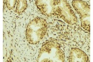 ABIN6276966 at 1/100 staining Mouse colon tissue by IHC-P.