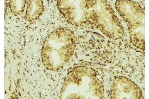 ABIN6276966 at 1/100 staining Mouse colon tissue by IHC-P. (RCAS1 anticorps  (C-Term))