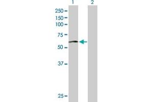 Western Blot analysis of ACCS expression in transfected 293T cell line by ACCS MaxPab polyclonal antibody. (PHACS anticorps  (AA 1-501))