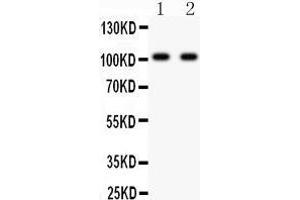 Anti- GRIA3 antibody, Western blotting All lanes: Anti GRIA3  at 0. (Glutamate Receptor 3 anticorps  (AA 29-360))