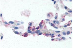 Human Lung, Neutrophils (formalin-fixed, paraffin-embedded) stained with EMR2 antibody ABIN213507 at 2-24 ug/ml followed by biotinylated goat anti-rabbit IgG secondary antibody ABIN481713, alkaline phosphatase-streptavidin and chromogen. (EMR2 anticorps  (N-Term))